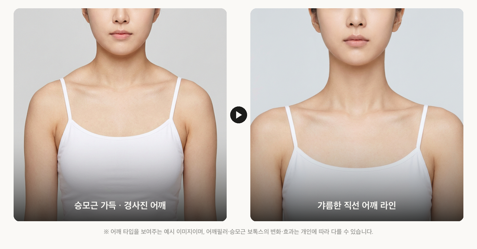 어깨 타입 비교 — 승모근 가득 경사진 어깨와 갸름한 직선 어깨 라인